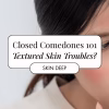 closed comodones skin troubles