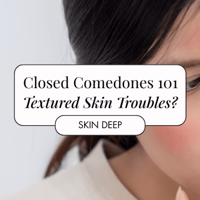 closed comodones skin troubles