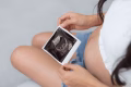 Pregnant woman holding baby ultrasound